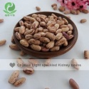 light speckled kidney beans - product's photo