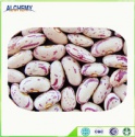 light speckled kidney beans(long shape) - product's photo