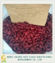 dark red kidney bean - product's photo