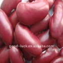 red kidney beans - product's photo